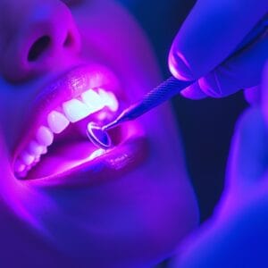 A man getting a white filling put in by a dentist