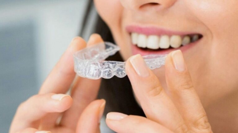 invisalign essex