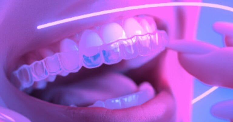 invisalign treatment essex