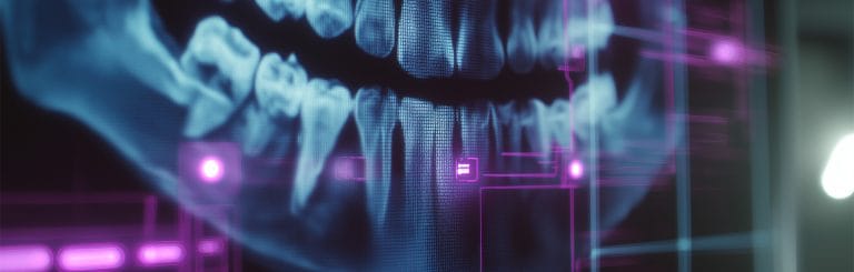 AI in Dental Diagnostics